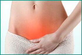 Cistitis en mujeres